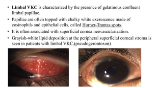 • Limbal VKC is characterized by the presence of gelatinous confluent
limbal papillae.
• Papillae are often topped with chalky white excrescence made of
eosinophils and epithelial cells, called Horner-Trantas spots.
• It is often associated with superficial cornea neovascularization.
• Grayish-white lipid deposition at the peripheral superficial corneal stroma is
seen in patients with limbal VKC.(pseudogerontoxon)
 
