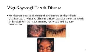 VKH AND SARCOIDOSIS final ppt.pptx................... | PPTX