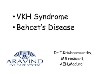 • VKH Syndrome 
• Behcet’s Disease 
Dr.T.Krishnamoorthy, 
MS resident, 
AEH,Madurai 
 
