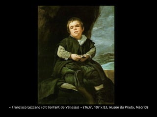 « Francisco Lezcano (dit l'enfant de Vallejas) » (1637, 107 x 83, Musée du Prado, Madrid)
 