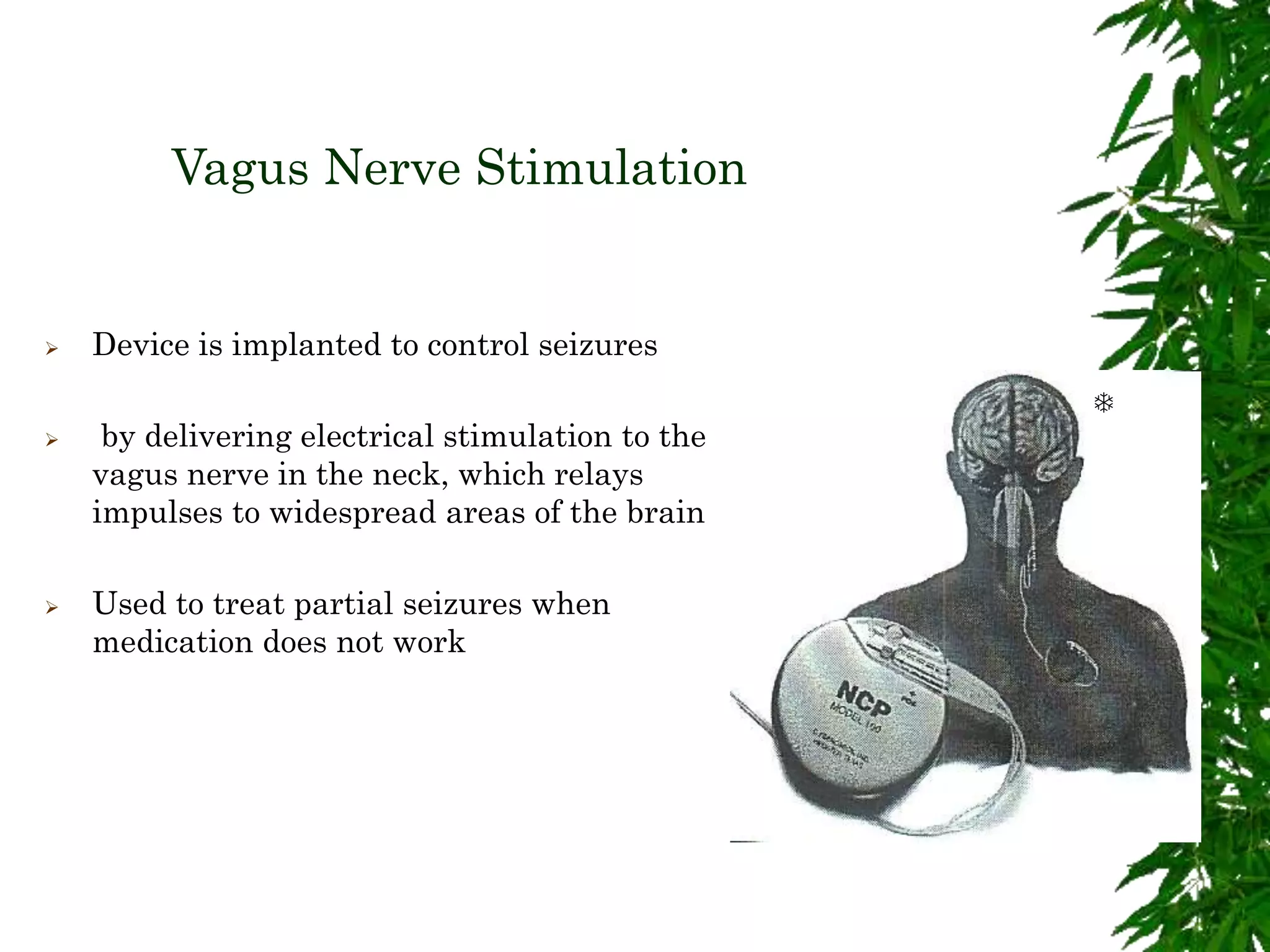 Vagus Nerve Stimulation
 Device is implanted to control seizures
 by delivering electrical stimulation to the
vagus nerve in the neck, which relays
impulses to widespread areas of the brain
 Used to treat partial seizures when
medication does not work

 