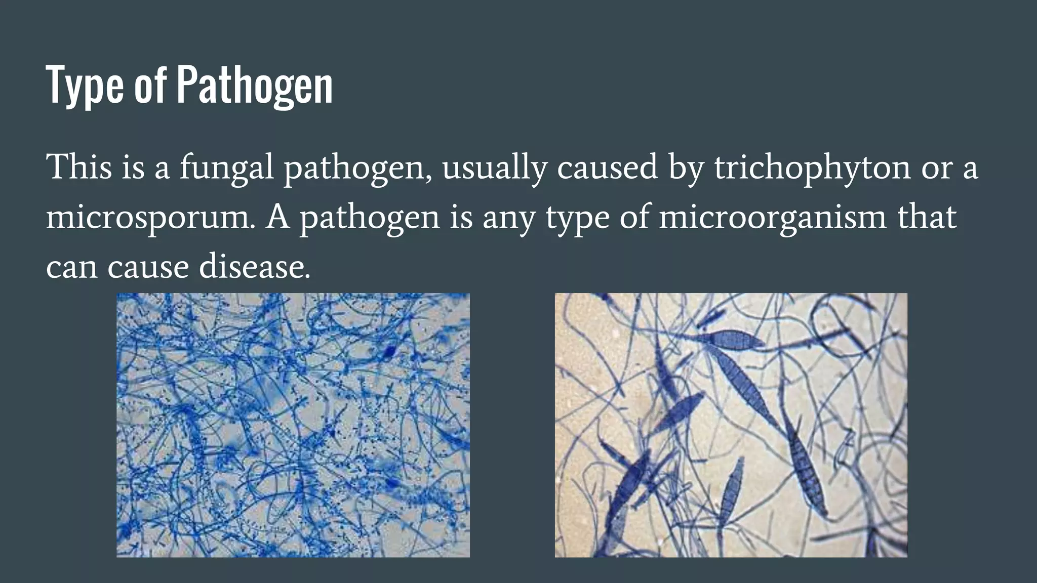 Type of Pathogen
This is a fungal pathogen, usually caused by trichophyton or a
microsporum. A pathogen is any type of microorganism that
can cause disease.
 