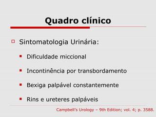 Quadro clínico
 Sintomatologia Urinária:
 Dificuldade miccional
 Incontinência por transbordamento
 Bexiga palpável constantemente
 Rins e ureteres palpáveis
Campbell’s Urology – 9th Edition; vol. 4; p. 3588.
 
