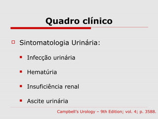 Quadro clínico
 Sintomatologia Urinária:
 Infecção urinária
 Hematúria
 Insuficiência renal
 Ascite urinária
Campbell’s Urology – 9th Edition; vol. 4; p. 3588.
 