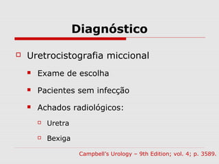 Diagnóstico
 Uretrocistografia miccional
 Exame de escolha
 Pacientes sem infecção
 Achados radiológicos:
 Uretra
 Bexiga
Campbell’s Urology – 9th Edition; vol. 4; p. 3589.
 