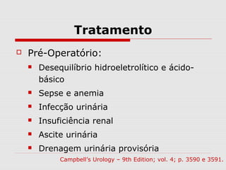 Tratamento
 Pré-Operatório:
 Desequilíbrio hidroeletrolítico e ácido-
básico
 Sepse e anemia
 Infecção urinária
 Insuficiência renal
 Ascite urinária
 Drenagem urinária provisória
Campbell’s Urology – 9th Edition; vol. 4; p. 3590 e 3591.
 