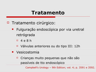 Tratamento
 Tratamento cirúrgico:
 Fulguração endoscópica por via uretral
retrógrada
 4 e 8 h
 Válvulas anteriores ou do tipo III: 12h
 Vesicostomia
 Crianças muito pequenas que não são
passíveis de tto endoscópico
Campbell’s Urology – 9th Edition; vol. 4; p. 3591 e 3592.
 