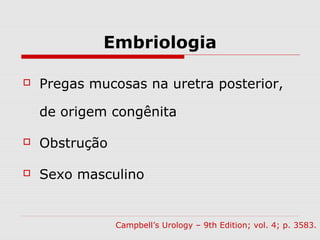 Embriologia
 Pregas mucosas na uretra posterior,
de origem congênita
 Obstrução
 Sexo masculino
Campbell’s Urology – 9th Edition; vol. 4; p. 3583.
 