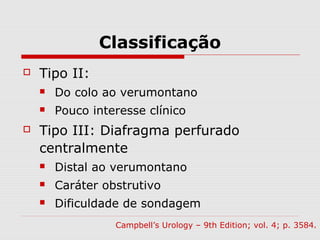 Classificação
 Tipo II:
 Do colo ao verumontano
 Pouco interesse clínico
 Tipo III: Diafragma perfurado
centralmente
 Distal ao verumontano
 Caráter obstrutivo
 Dificuldade de sondagem
Campbell’s Urology – 9th Edition; vol. 4; p. 3584.
 