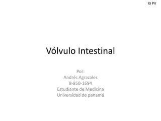 Vólvulo Intestinal
Por:
Andrés Agrazales
8-850-1694
Estudiante de Medicina
Universidad de panamá
XI PV
 