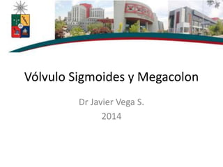 Vólvulo Sigmoides y Megacolon
Dr Javier Vega S.
2014
 