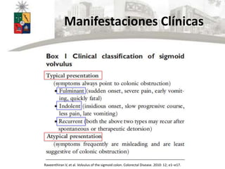Manifestaciones Clínicas
Raveenthiran V, et al. Volvulus of the sigmoid colon. Colorectal Disease. 2010: 12; e1–e17.
 