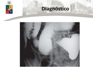 Diagnóstico
 