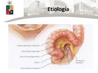 Etiología
 