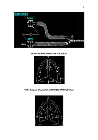 3

VENTILAÇÃO ESPONTANEA NORMAL

VENTILAÇÃO MECÂNICA COM PRESSÃO POSITIVA

 