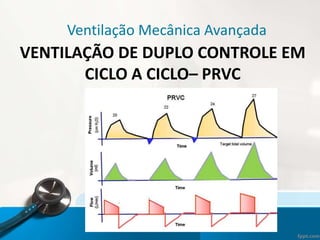 Ventilação Mecânica Avançada
VENTILAÇÃO DE DUPLO CONTROLE EM
CICLO A CICLO– PRVC
 