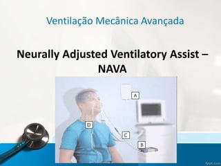 Ventilação Mecânica Avançada
Neurally Adjusted Ventilatory Assist –
NAVA
 
