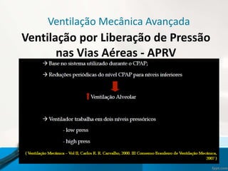 Ventilação Mecânica Avançada
Ventilação por Liberação de Pressão
nas Vias Aéreas - APRV
 