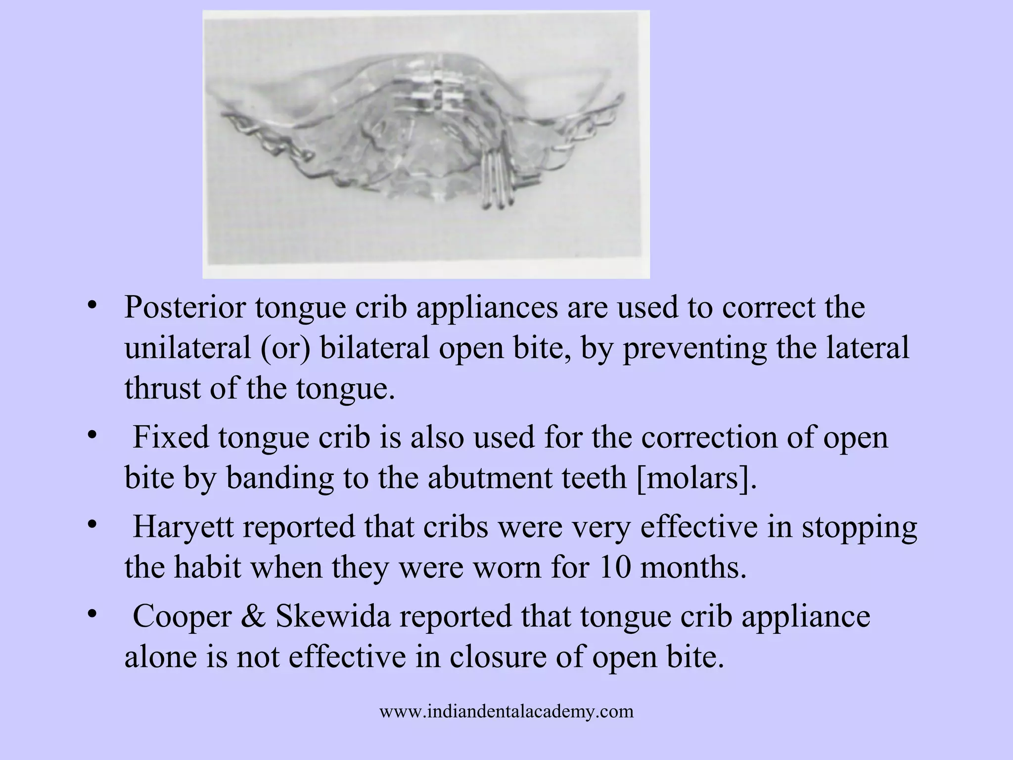 • Posterior tongue crib appliances are used to correct the
unilateral (or) bilateral open bite, by preventing the lateral
thrust of the tongue.
• Fixed tongue crib is also used for the correction of open
bite by banding to the abutment teeth [molars].
• Haryett reported that cribs were very effective in stopping
the habit when they were worn for 10 months.
• Cooper & Skewida reported that tongue crib appliance
alone is not effective in closure of open bite.
www.indiandentalacademy.com

 