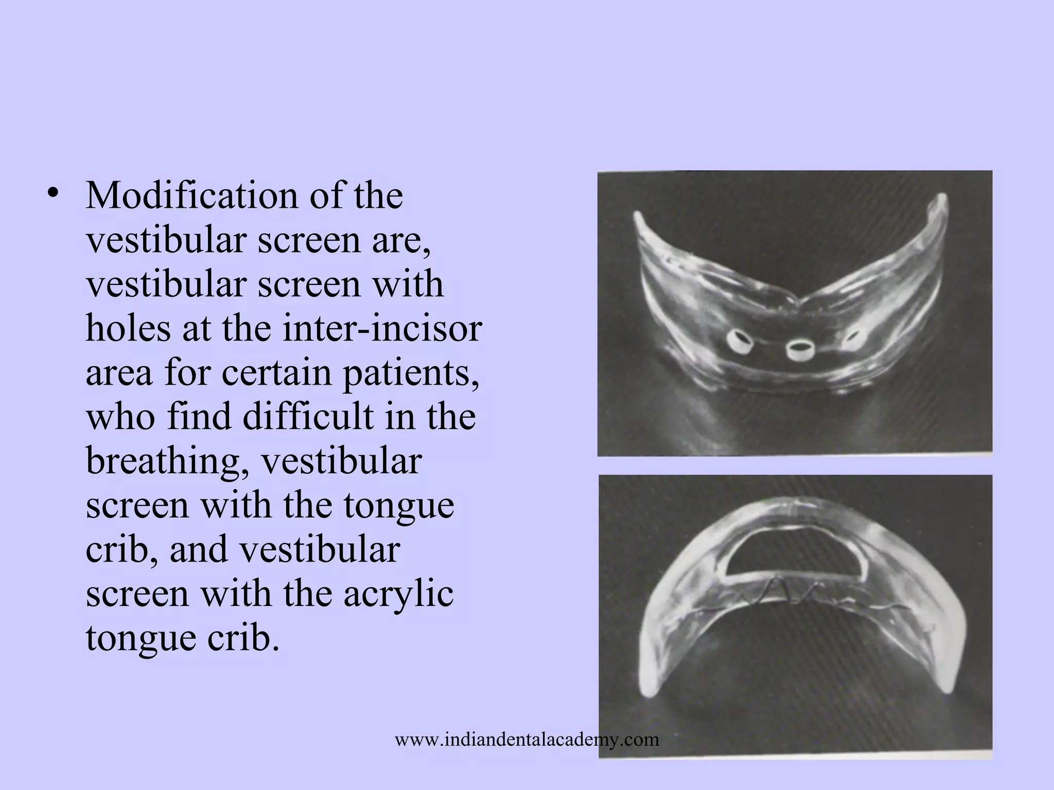 • Modification of the
vestibular screen are,
vestibular screen with
holes at the inter-incisor
area for certain patients,
who find difficult in the
breathing, vestibular
screen with the tongue
crib, and vestibular
screen with the acrylic
tongue crib.
www.indiandentalacademy.com

 