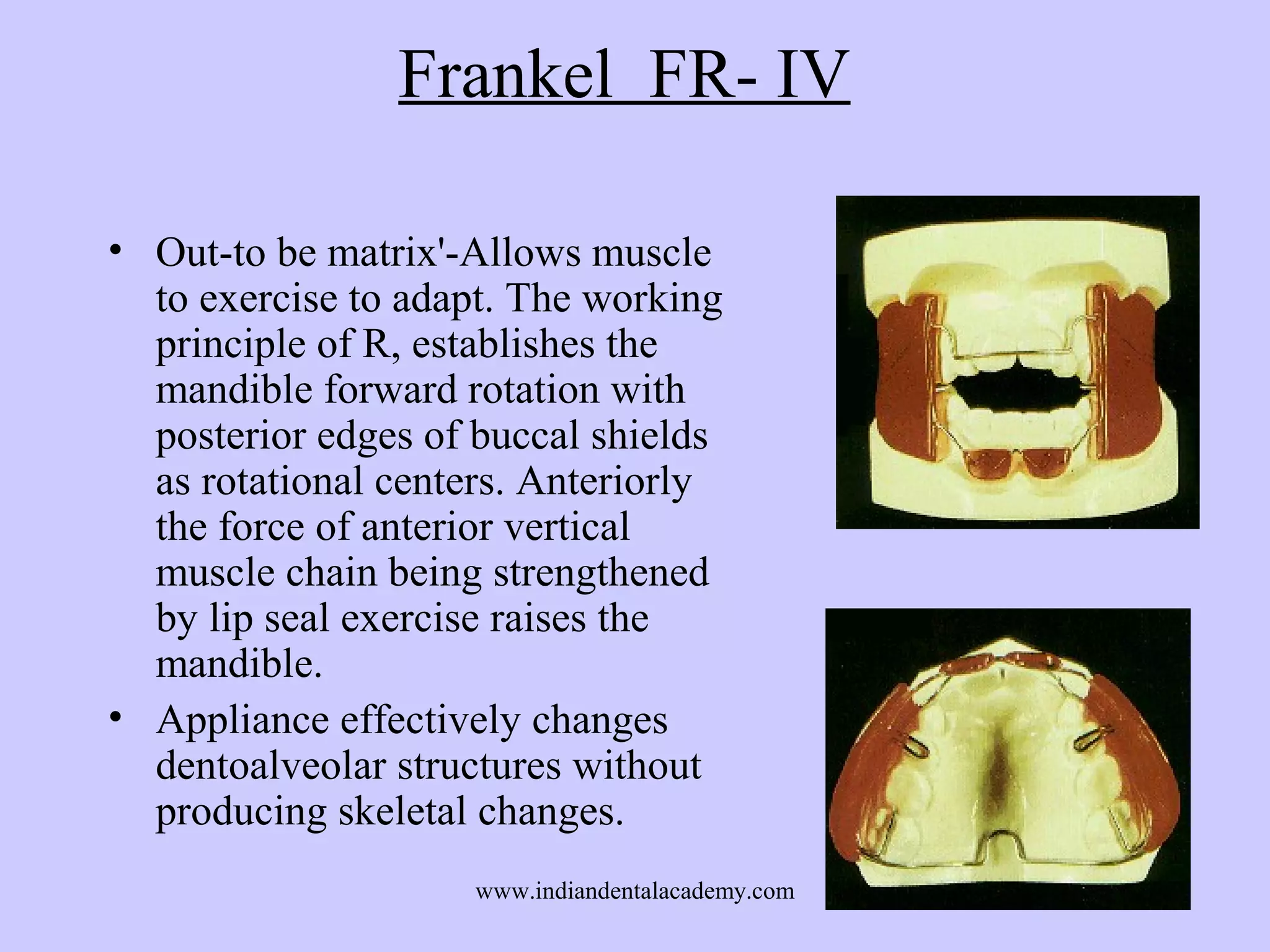 Frankel FR- IV
• Out-to be matrix'-Allows muscle
to exercise to adapt. The working
principle of R, establishes the
mandible forward rotation with
posterior edges of buccal shields
as rotational centers. Anteriorly
the force of anterior vertical
muscle chain being strengthened
by lip seal exercise raises the
mandible.
• Appliance effectively changes
dentoalveolar structures without
producing skeletal changes.
www.indiandentalacademy.com

 