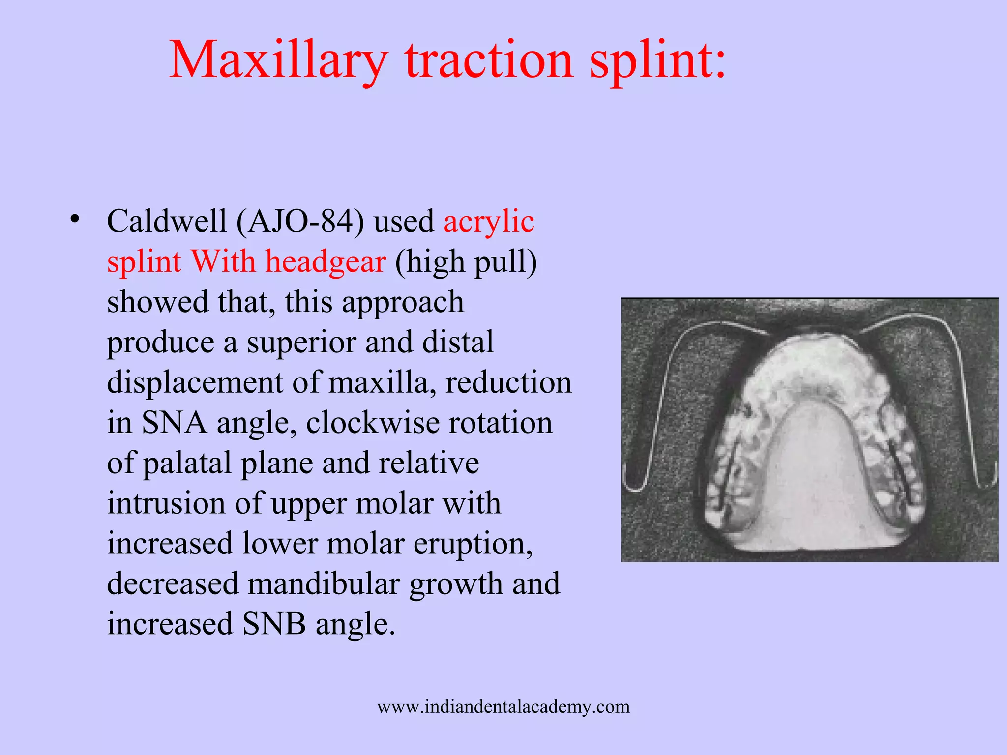 Maxillary traction splint:
• Caldwell (AJO-84) used acrylic
splint With headgear (high pull)
showed that, this approach
produce a superior and distal
displacement of maxilla, reduction
in SNA angle, clockwise rotation
of palatal plane and relative
intrusion of upper molar with
increased lower molar eruption,
decreased mandibular growth and
increased SNB angle.
www.indiandentalacademy.com

 
