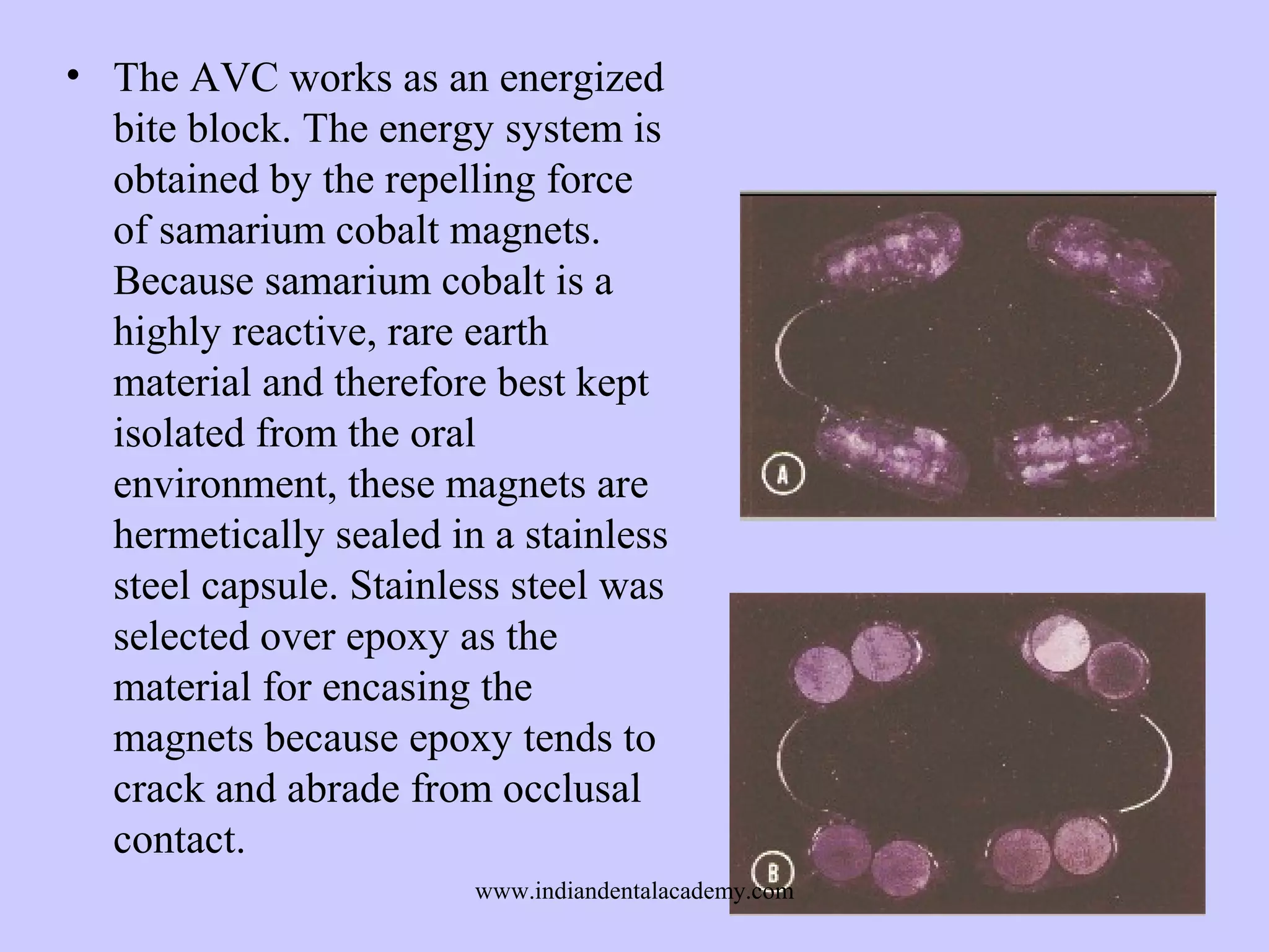 • The AVC works as an energized
bite block. The energy system is
obtained by the repelling force
of samarium cobalt magnets.
Because samarium cobalt is a
highly reactive, rare earth
material and therefore best kept
isolated from the oral
environment, these magnets are
hermetically sealed in a stainless
steel capsule. Stainless steel was
selected over epoxy as the
material for encasing the
magnets because epoxy tends to
crack and abrade from occlusal
contact.
www.indiandentalacademy.com

 