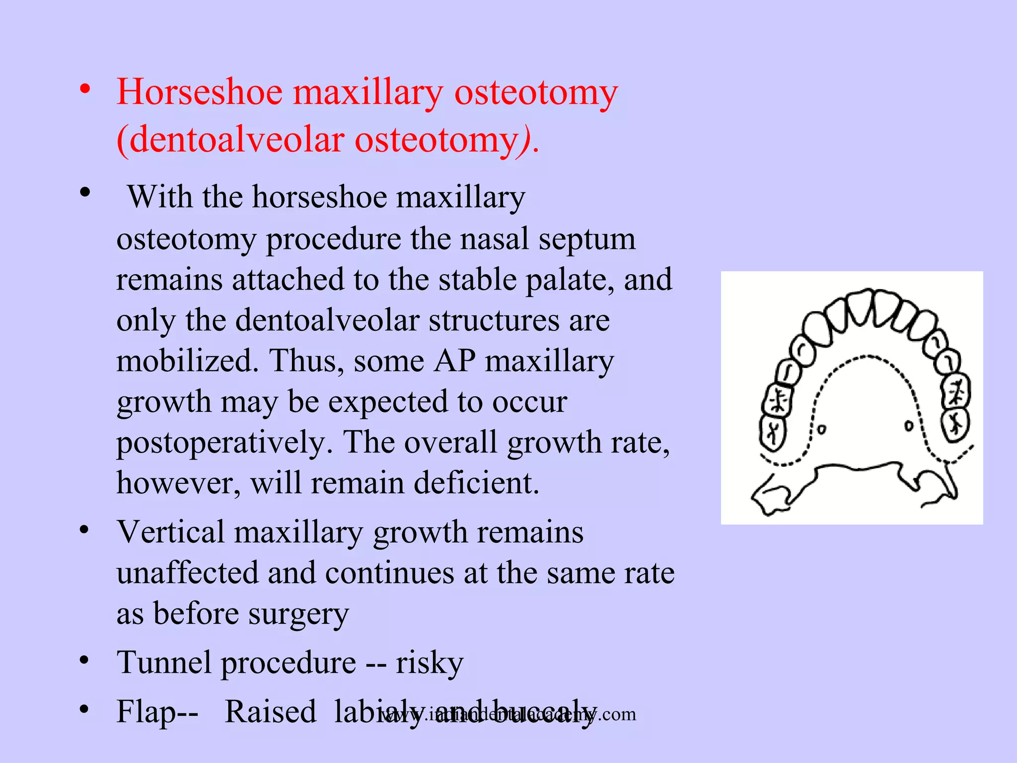 • Horseshoe maxillary osteotomy
(dentoalveolar osteotomy).
• With the horseshoe maxillary
osteotomy procedure the nasal septum
remains attached to the stable palate, and
only the dentoalveolar structures are
mobilized. Thus, some AP maxillary
growth may be expected to occur
postoperatively. The overall growth rate,
however, will remain deficient.
• Vertical maxillary growth remains
unaffected and continues at the same rate
as before surgery
• Tunnel procedure -- risky
• Flap-- Raised labialy and buccaly
www.indiandentalacademy.com

 