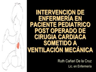 INTERVENCION DE ENFERMERÍA EN PACIENTE PEDIATRICO POST OPERADO DE CIRUGIA CARDIACA SOMETIDO A VENTILACIÓN MECÁNICA Ruth Cañari De la Cruz Lic. en Enfermería 