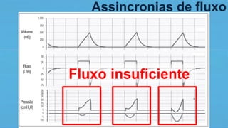 Assincronias de fluxo
Fluxo insuficiente
 