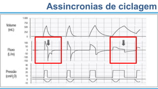 Assincronias de ciclagem
 