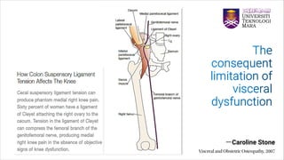 Visceral Manipulation In UiTM 2022.pdf