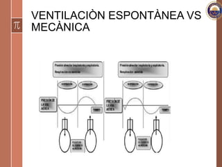 VENTILACIÒN ESPONTÀNEA VS
MECÀNICA
 
