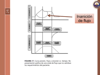 Inanición
de flujo
 