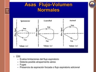 ›  Ùtil:
–  Evalúa limitaciones del flujo espiratorio
–  Detecta posible atrapamiento aèreo
–  Fugas
–  Presencia de espiración forzada o flujo espiratorio adicional
 