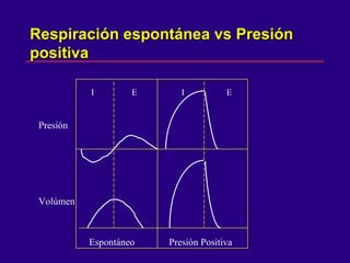 Respiración espontánea vs Presión positiva  I  E  I  E Presión Volúmen Espontáneo  Presión Positiva  I  E  I  E 