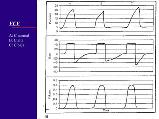 VCV A: C normal B: C alta C: C baja 