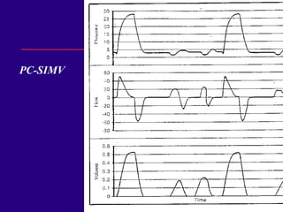 PC-SIMV 