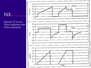 VCV  Relación I:E inversa Flujo inspiratorio bajo Pausa inspiratoria 