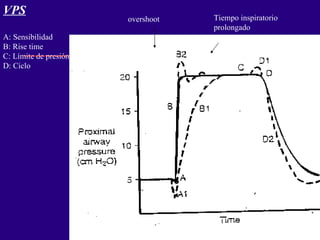 VPS A: Sensibilidad B: Rise time C: Límite de presión D: Ciclo overshoot Tiempo inspiratorio prolongado 