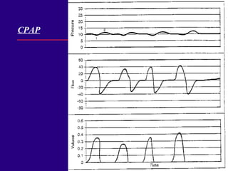 CPAP 