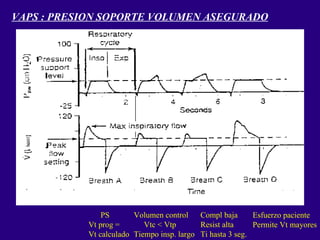 VAPS : PRESION SOPORTE VOLUMEN ASEGURADO PS Vt prog = Vt calculado Volumen control Vtc < Vtp Tiempo insp. largo Compl baja Resist alta Ti hasta 3 seg. Esfuerzo paciente Permite Vt mayores 