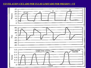 VENTILACION CICLADO POR FLUJO LIMITADO POR PRESION = VS 