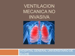 VENTILACION
 MECANICA NO
   INVASIVA




HOSPITAL GENERAL UNIVERSITARIO DE
ELCHE
 