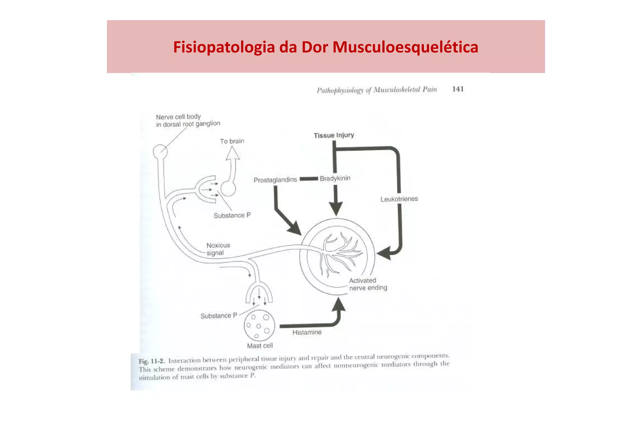 Fisiopatologia da Dor Musculoesquelética
 