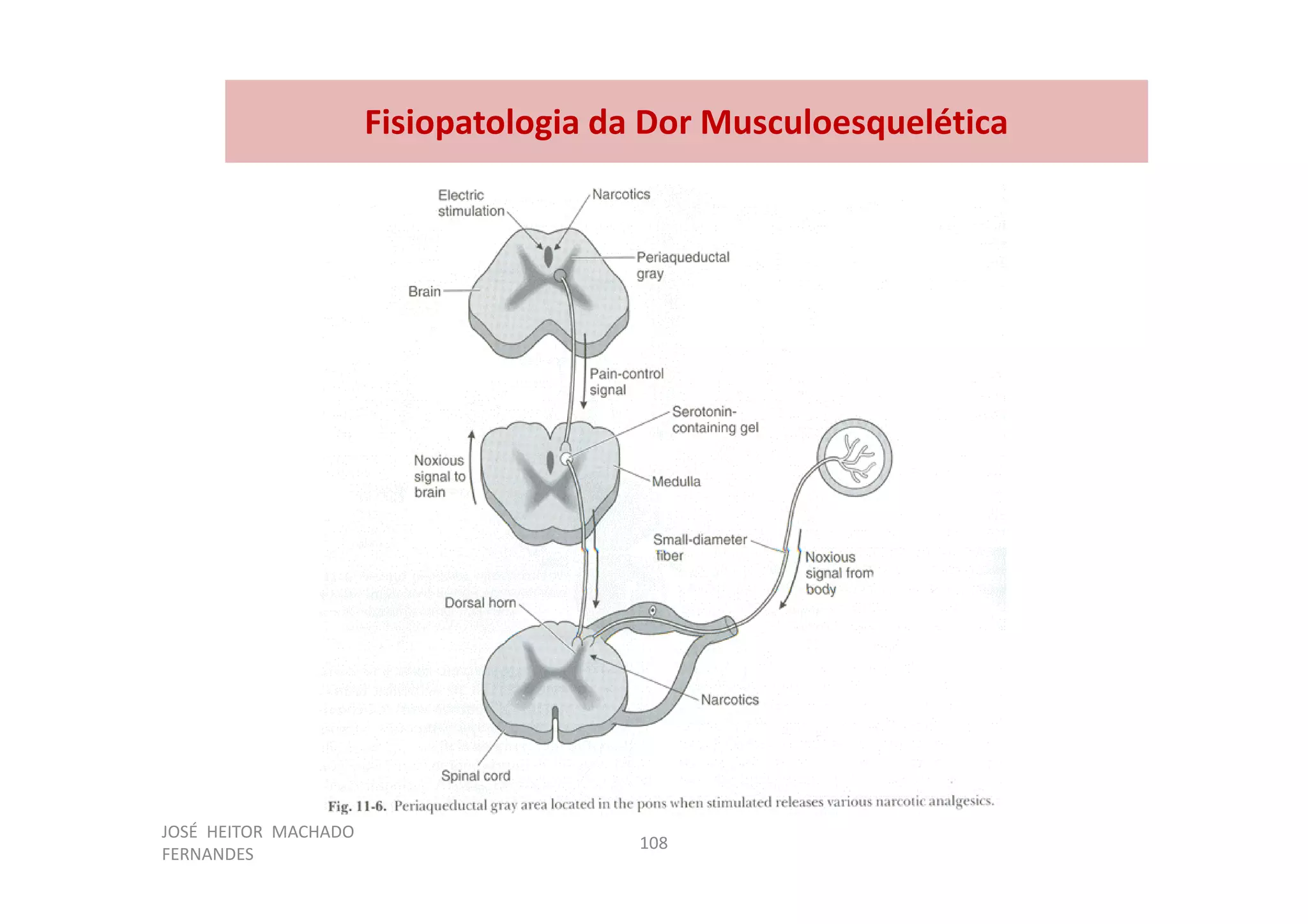 JOSÉ HEITOR MACHADO
FERNANDES
108
Fisiopatologia da Dor Musculoesquelética
 