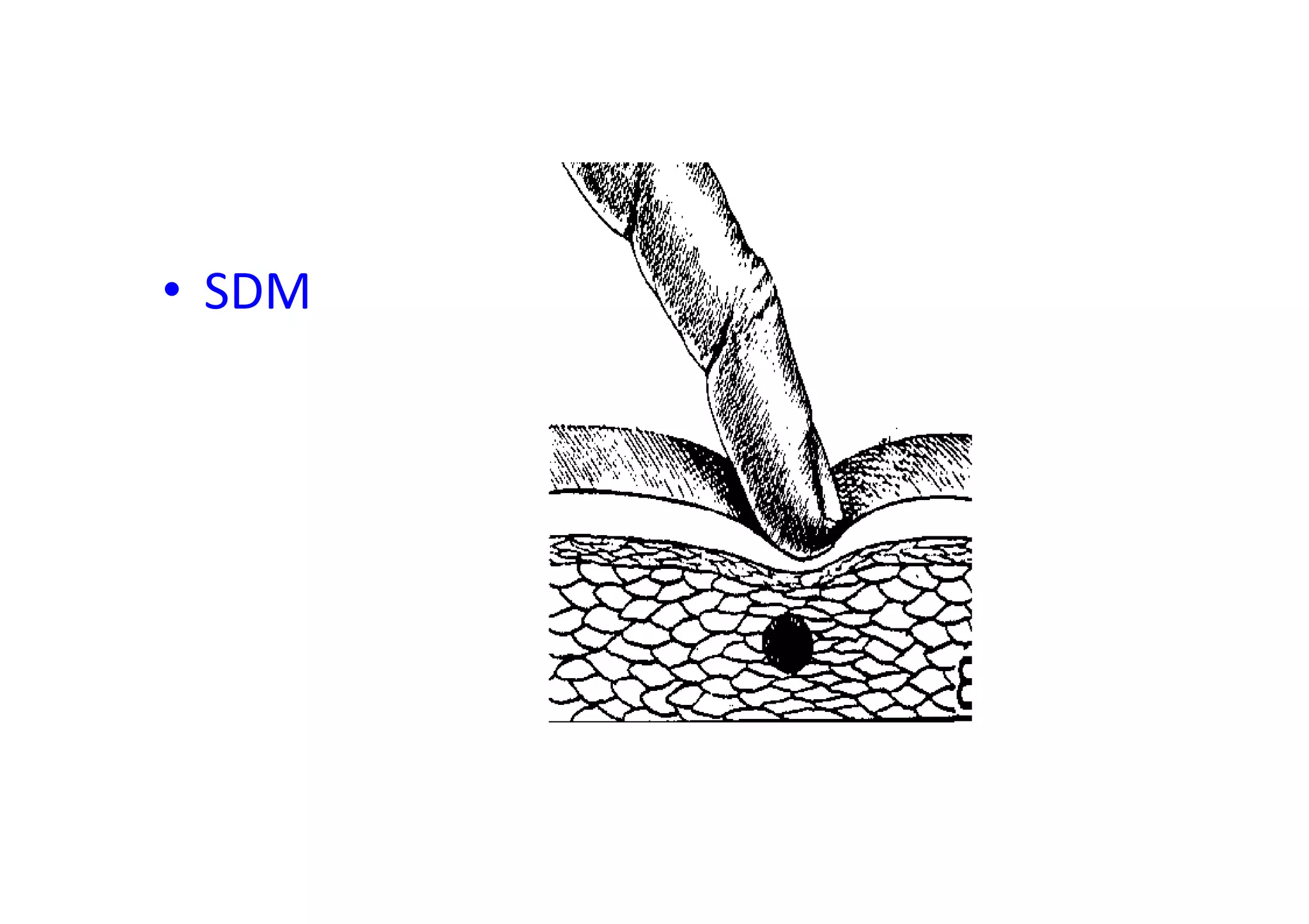 • SDM
 