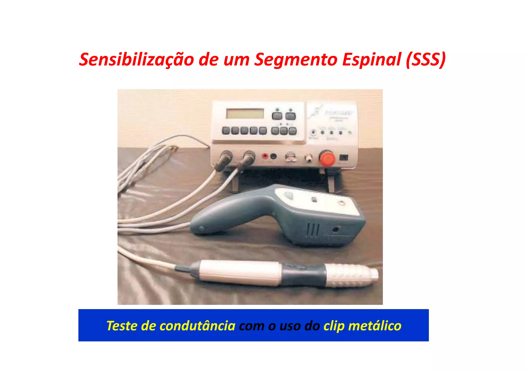 Sensibilização de um Segmento Espinal (SSS)
Teste de condutância com o uso do clip metálico
 