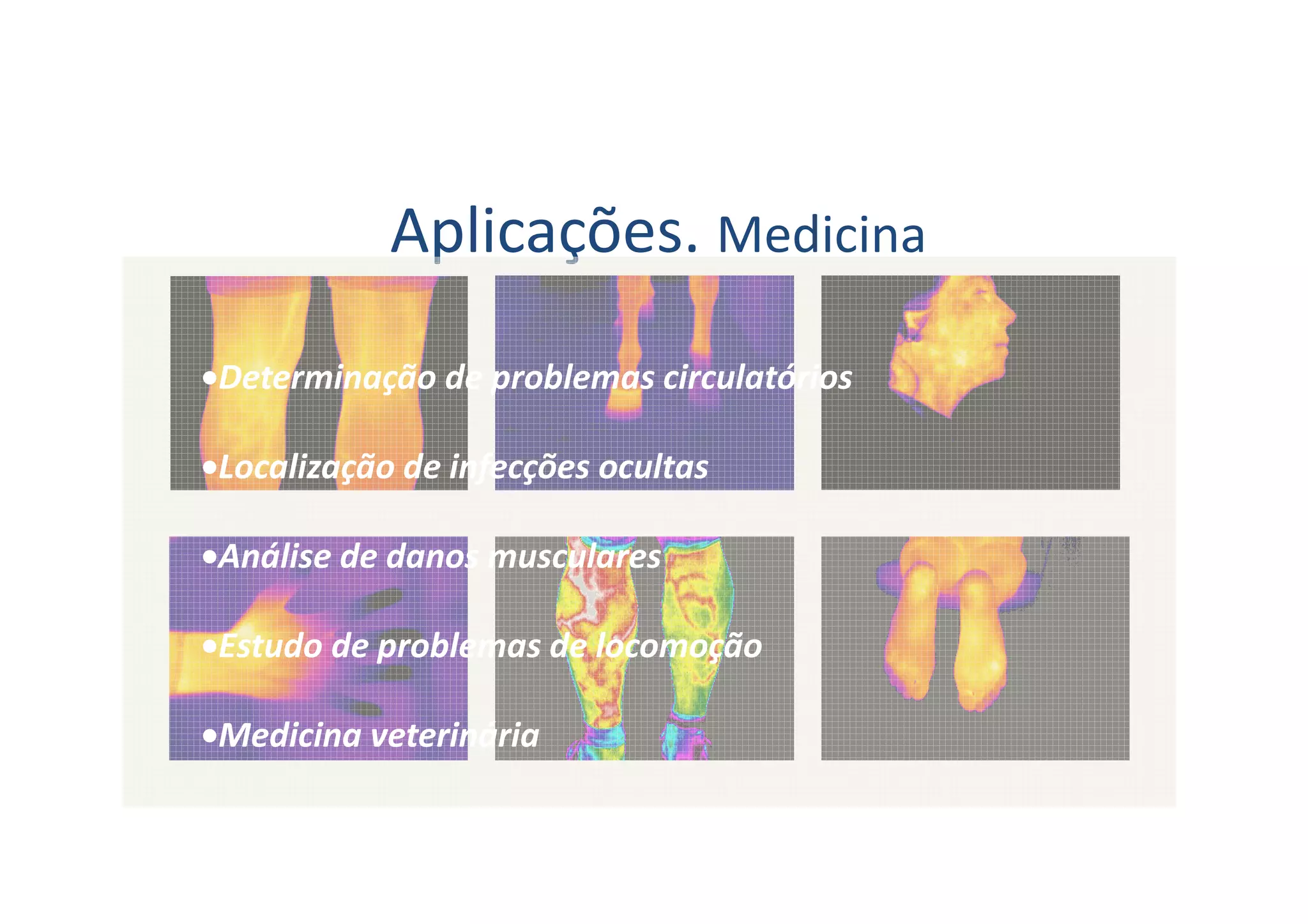 Aplicações. Medicina
•Determinação de problemas circulatórios
•Localização de infecções ocultas
•Análise de danos musculares
•Estudo de problemas de locomoção
•Medicina veterinária
 