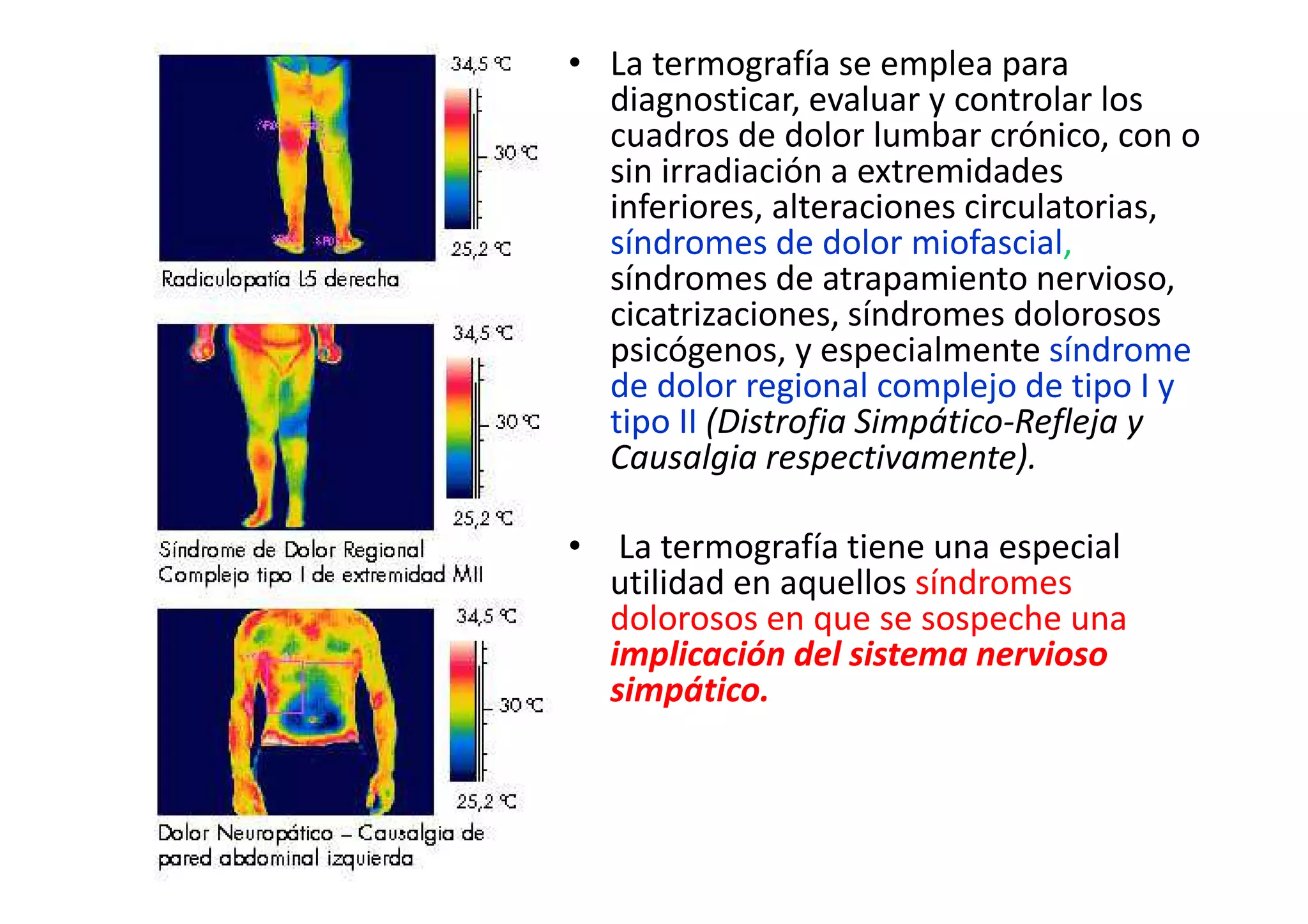 • La termografía se emplea para
diagnosticar, evaluar y controlar los
cuadros de dolor lumbar crónico, con o
sin irradiación a extremidades
inferiores, alteraciones circulatorias,
síndromes de dolor miofascial,
síndromes de atrapamiento nervioso,
cicatrizaciones, síndromes dolorosos
psicógenos, y especialmente síndrome
de dolor regional complejo de tipo I y
tipo II (Distrofia Simpático-Refleja y
Causalgia respectivamente).
• La termografía tiene una especial
utilidad en aquellos síndromes
dolorosos en que se sospeche una
implicación del sistema nervioso
simpático.
 